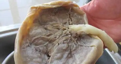 胎盘这样处理后对宝宝有大好处,涨知识了!