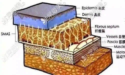 面部smas筋膜提升到底好不好听资深皮肤科医生怎么说