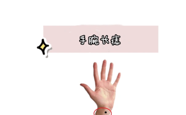 痣的位置关乎着你运势的好坏手腕处有痣代表是好是坏呢