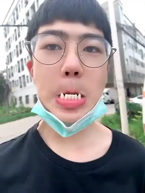 17岁男孩长着奇怪的牙齿上下都有这样的虎牙像不像电影里的那谁