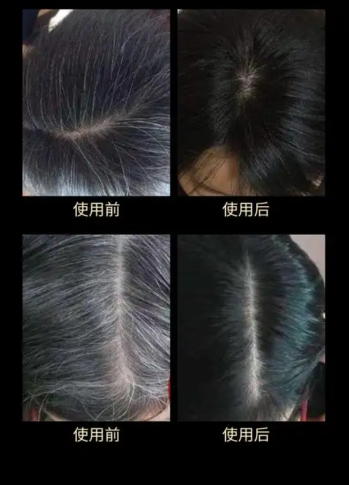 仁和黑灵芝何首乌植萃精华皂乌发黑发洗发水白转黑洗发乳皂 厂家