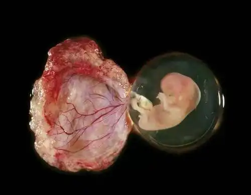 妈妈产后吃胎盘,感觉皮肤变好了,是谣言还是真有科学依据