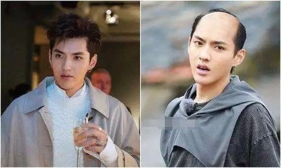 男明星变秃顶后鹿晗很爷们王俊凯变油腻大叔而杨洋依然帅气