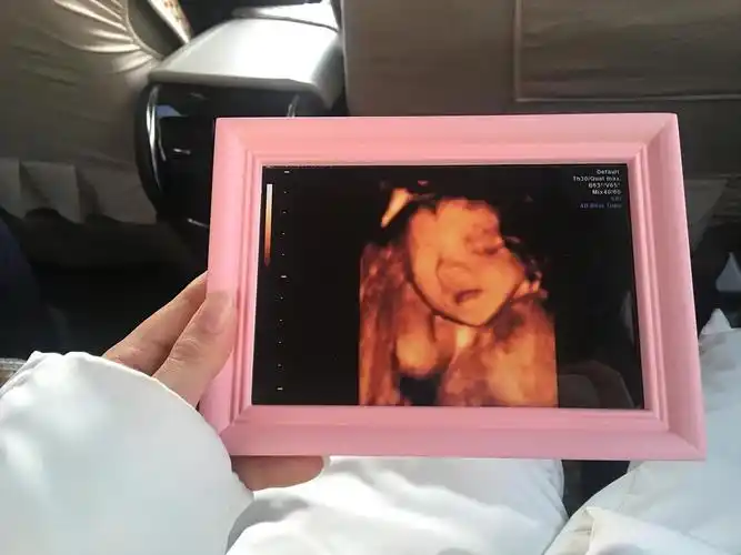 万幸王瞧瞧如我们全家所愿,是个可爱的女孩子,大眼睛大耳朵,唯一就是