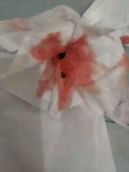 月经第第一天是这个颜色,请问这正常吗