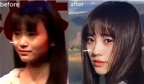 鞠婧祎整容前后对比判若两人(四千年美女鞠婧祎) - 好技术常识经验网