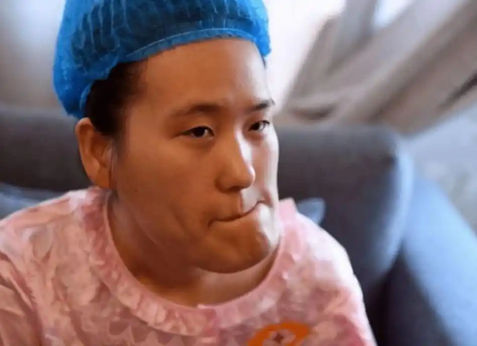 歪脸是什么原因导致的?正颌手术能矫正歪脸吗?