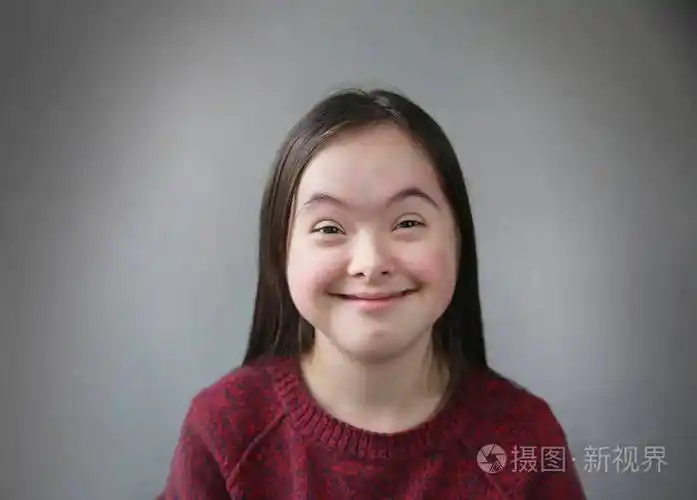 灰色背景下可爱的微笑唐氏综合症女孩照片-正版商用图片17cns0-摄图新