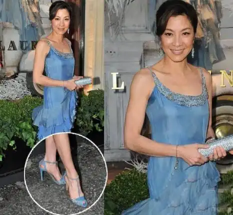 除了高跟鞋的原因,可能也因为一些打戏让足部严重受损,导致大脚骨问题