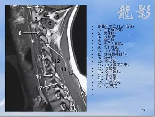 核磁共振和脊柱解剖