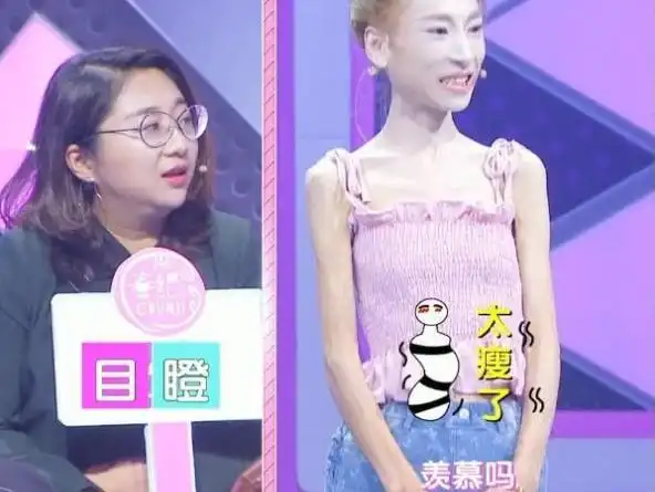 时隔2年,因为网恋从128斤瘦到58斤的"排骨妹"现状如何?