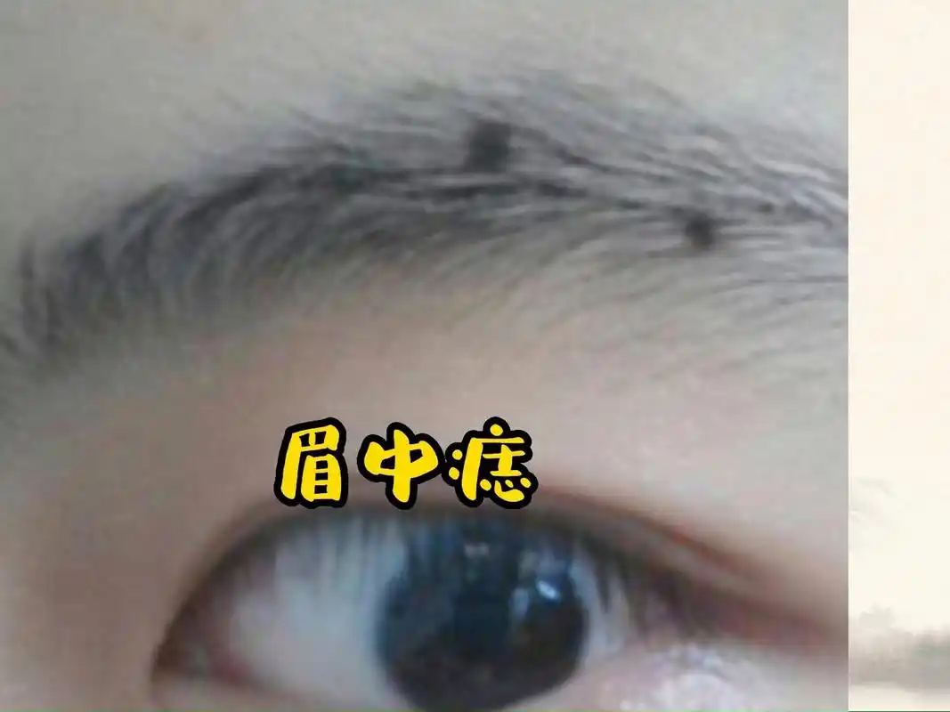 识人有术,眉中有痣 眉中生有漆黑之痣,而不外露者,谓之"草木藏珠"