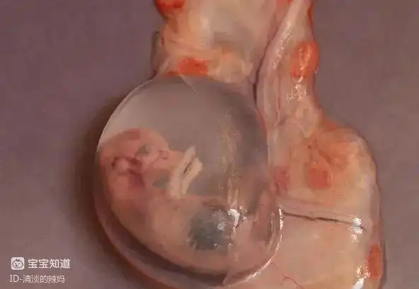 四月孕妇做饭的时候流产,竟是因为端锅,孕妇到底该不该做家务