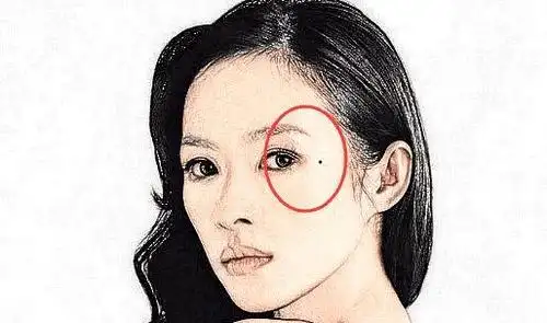 克夫痣女人脸上有五处恶痣易离婚或是多婚