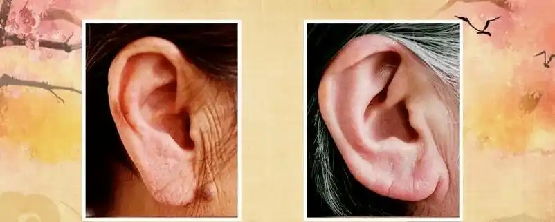 从耳朵看面相_面相耳朵看不见_面相耳朵看不到