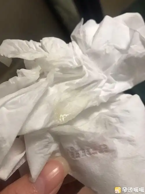 孕期正常的白带是怎样的?