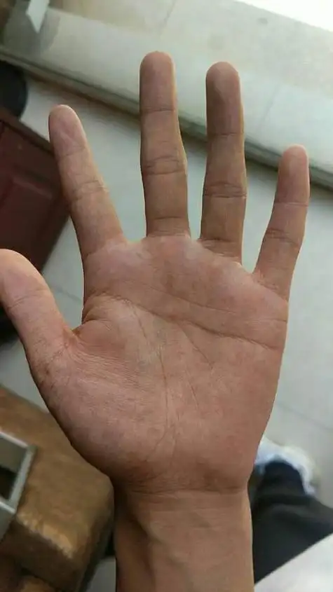 左手断掌纹的男人运势分析左手断掌的男人命运