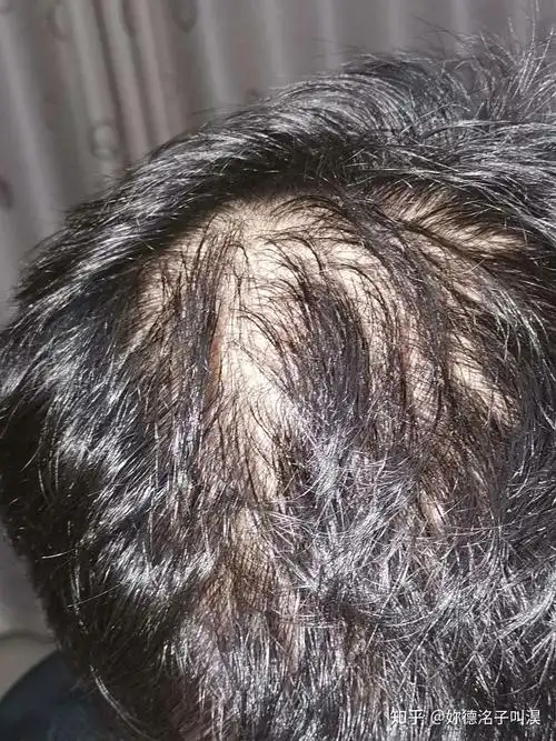 男生头发少稀疏细软适合留什么发型