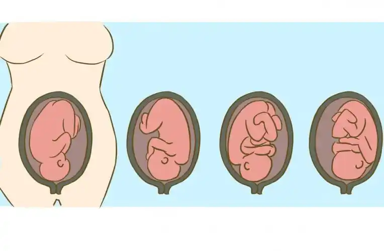 roa简介(roa是什么意思)