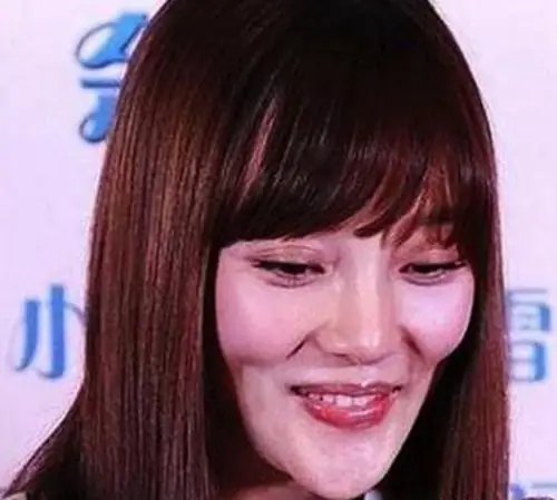 整容过度的九位女星整好了那叫换头整不好堪称毁容