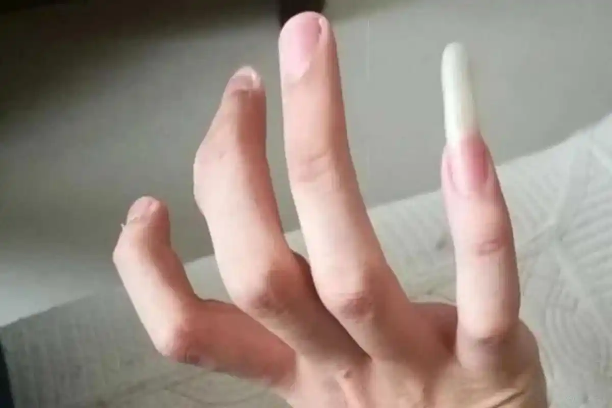 特别讨厌小手指留长指甲的男生 我的强迫症又犯了  如果是女生,满手的