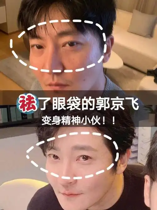 郭京飞祛眼袋后变身精神小伙