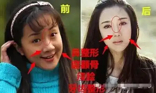 李依晓整容前后照片对比 起诉叶璇扭曲狗咬事件真相