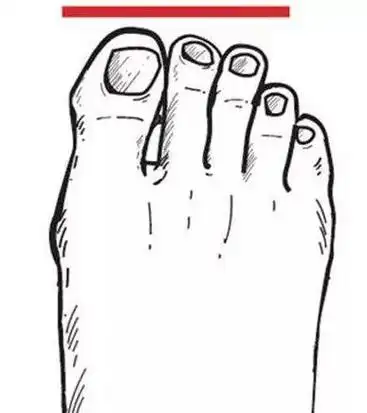 简笔画脚趾头的画法
