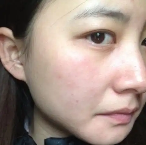 8个导致皮肤变差的原因你一定要知道