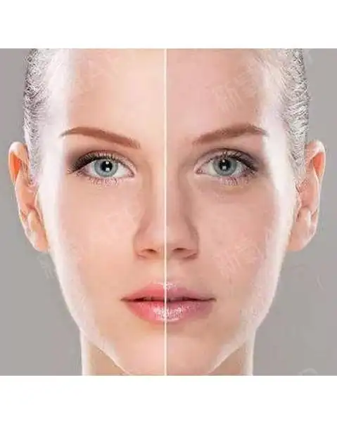 肤色暗沉不均,四个方法教你变水嫩牛奶肌!