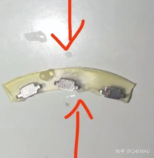 包皮拆钉超强攻略