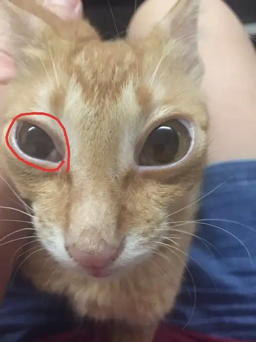 【讨论】右眼瞳孔浑浊