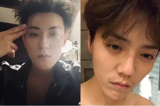 张艺兴真实素颜照流出,皮肤松弛,仪态全无,29岁就疲态尽显|鹿晗