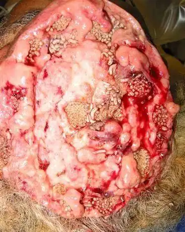 日本人吃寿司吃到脑袋起蛆~鄙视它们(恶心图片)