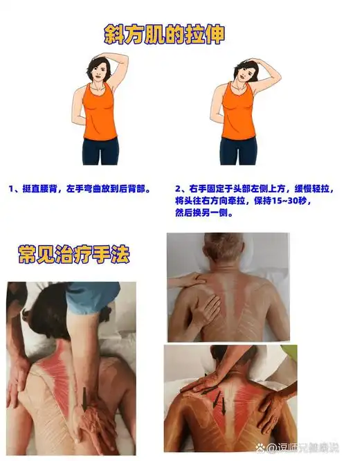 斜方肌(气质肌)