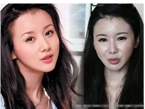 萧蔷王祖贤莫小棋孙菲菲 因整容面目全非女星【5】