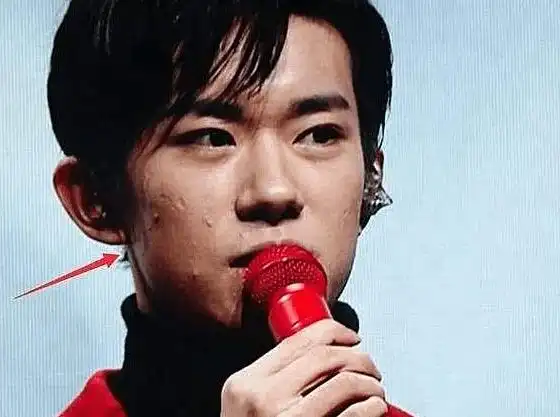 当然了,也希望千玺能够好好美丽皮肤,不然的话长大后会后悔的!