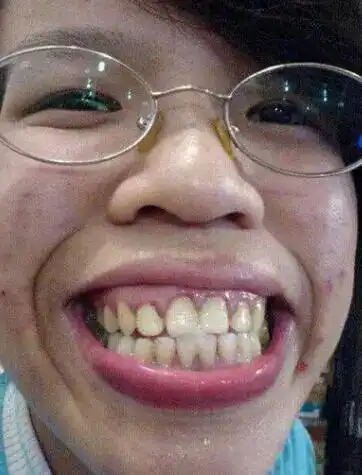 我来放烟雾了!世界上最丑的女人排行榜,心脏不好别看!