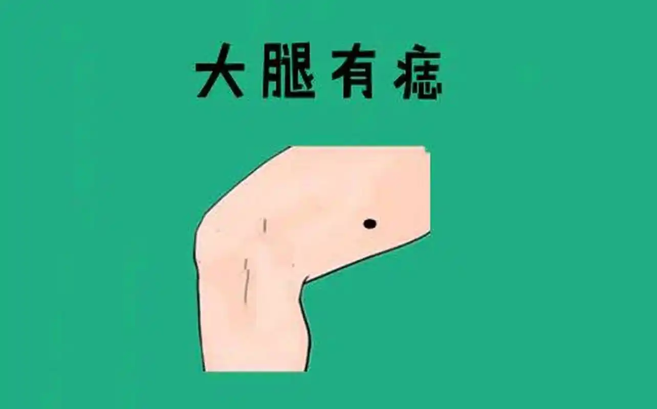 大腿有痣  大腿长痣的人是福气和富贵的象征,如果这个痣长在大腿外侧