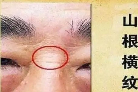 鼻梁上有横纹那么这个人的一生必定会有有一次重大的挫折.