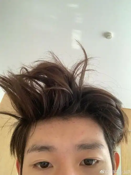 tfboys王源竟然这么丑自拍鸡窝头额头数颗痘还是那么帅