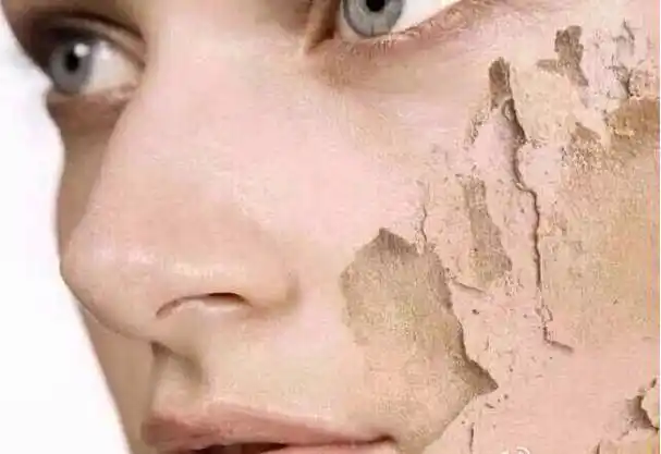 脸上有这个现象的女生,再不补水就会越来越丑 !_皮肤