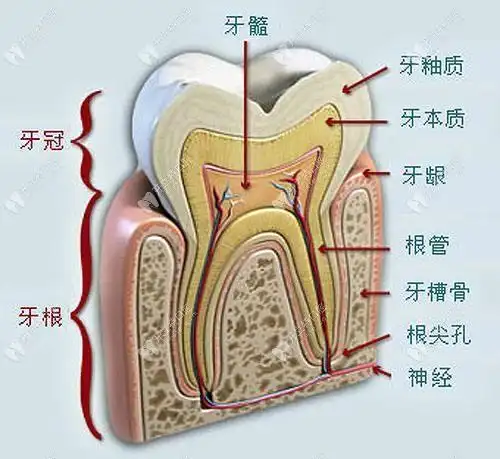做过正畸的人应该知道骨钉其实就是牙齿矫正的一种辅助装置,钉在牙槽