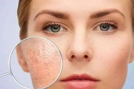 皮肤严重缺水,脸上会呈现这5个"信号",特别第2个很多人中招