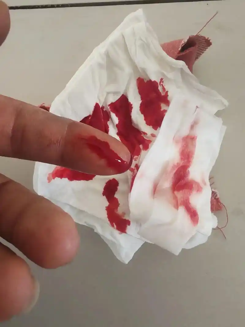 激动的心,颤抖的手,一不小心割到手!俗话说:常在河边走,哪有不湿鞋