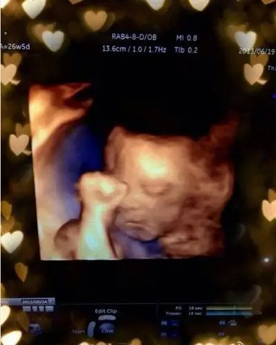 霍思燕怀孕8月晒胎儿b超照 自拍学婴儿姿势卖萌