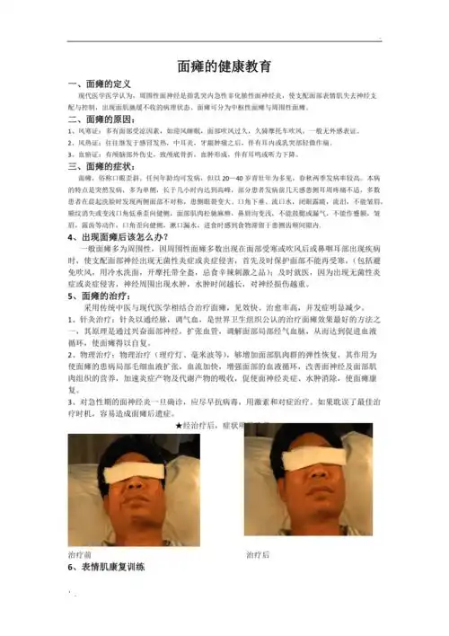 面瘫的健康宣教
