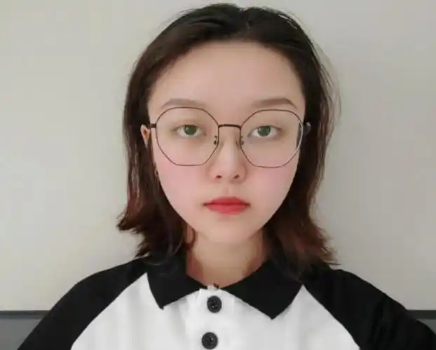 做了全飞秒近视手术后,学霸女神的双眼视力恢复到了1.0!