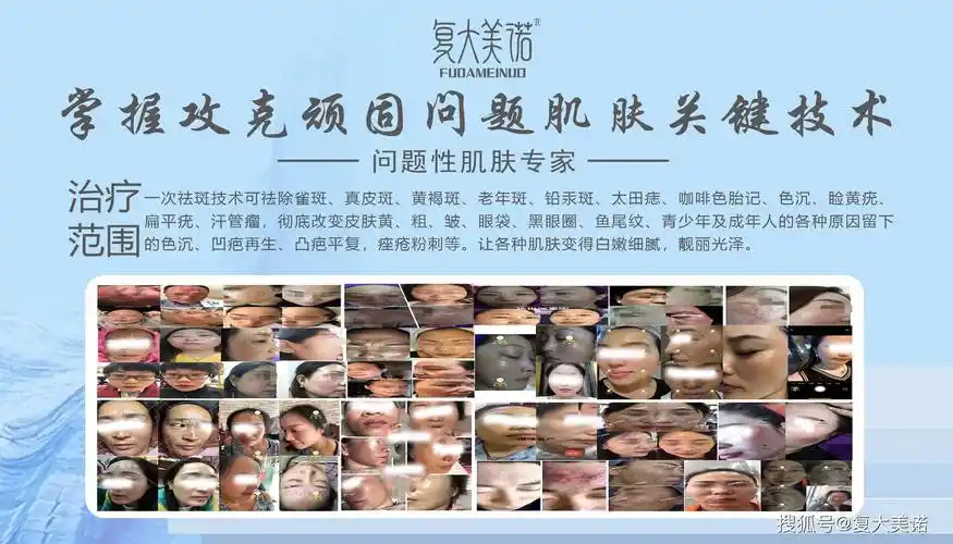 复大美诺问题性皮肤化妆品经销商(专业调肤二十年)