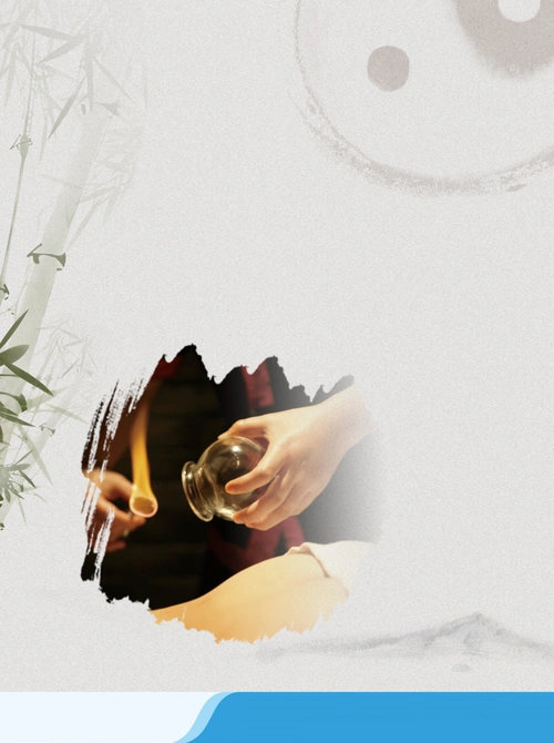 中医养生拔罐宣传海报背景模板